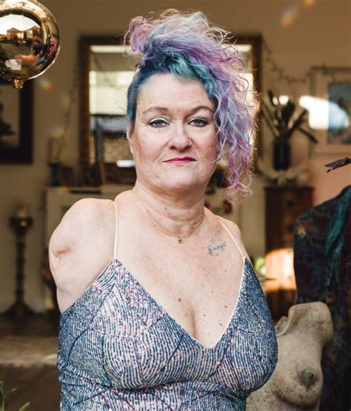 Alison Lapper- Wiki, Age, Height, Net Worth, Husband, Ethnicity