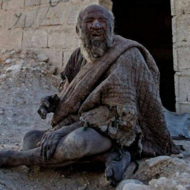Amou Haji Also Know As World’s Dirtiest Man Passed Away At The Age Of 94