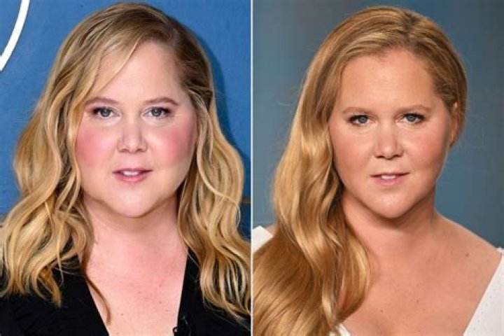 Amy Schumer Is Facing Backlash After Making Jokes About Jennifer Lawrence’s Weight