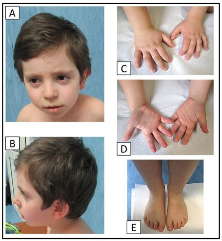 Davon Wade Sister Suffered From Microdeletion Syndrome- Know More About His Personal Life