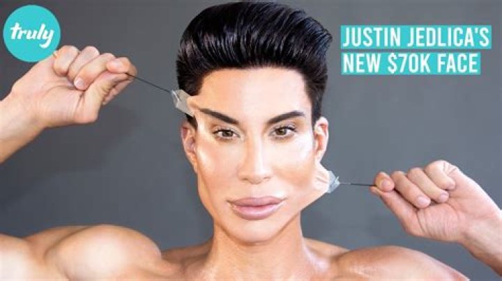 Justin Jedlica Made An Incredible Comeback On Ecosmetic’s Surgery Program Called Botched.