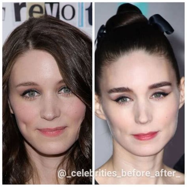 Kate Mara Nose Surgery: Before And After Photo