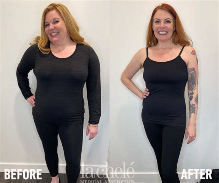Kim Gardner Weight Loss: Before And After Photo