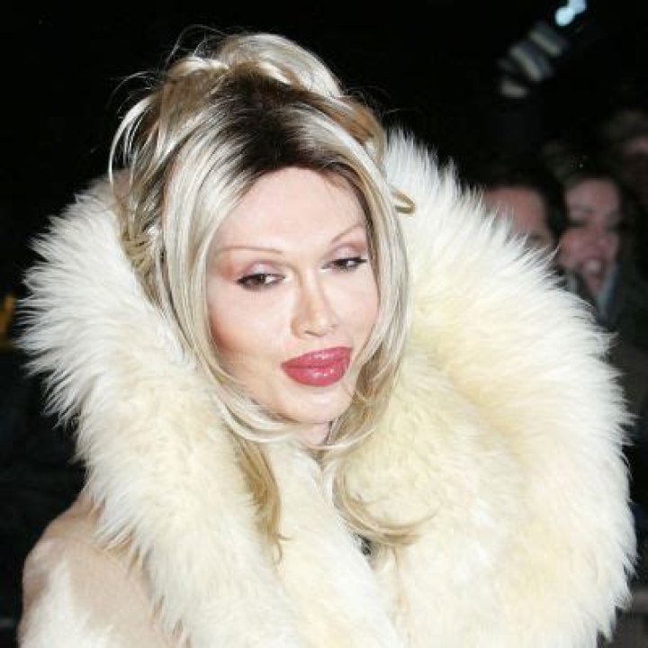 Pete Burns Sexuality: Was She Transgender? Transformation And Surgery Details