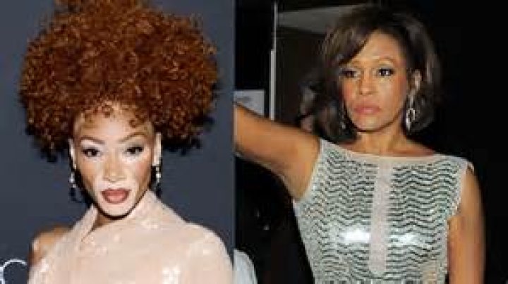 Winnie Harlow- Wiki, Age, Height, Net Worth, Boyfriend, Career